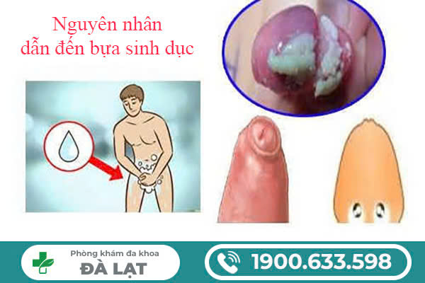 Hình ảnh minh họa